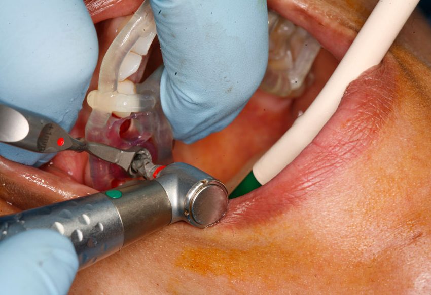 Oral-Surgery