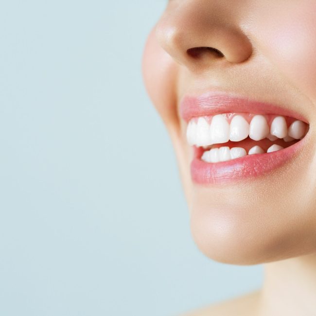 TREATMENT_perfect_healthy_teeth_smile_young_woman_teeth_whitening_dental_care_stomatology_concept_efeae53ab5
